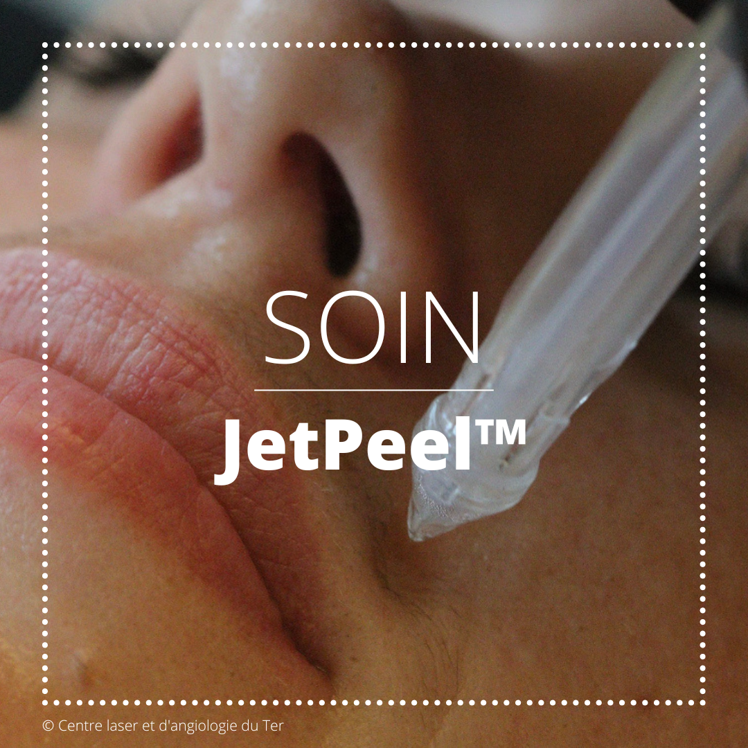 Soin jetpeel aux actifs naturels au Centre laser et d'angiologie du Ter