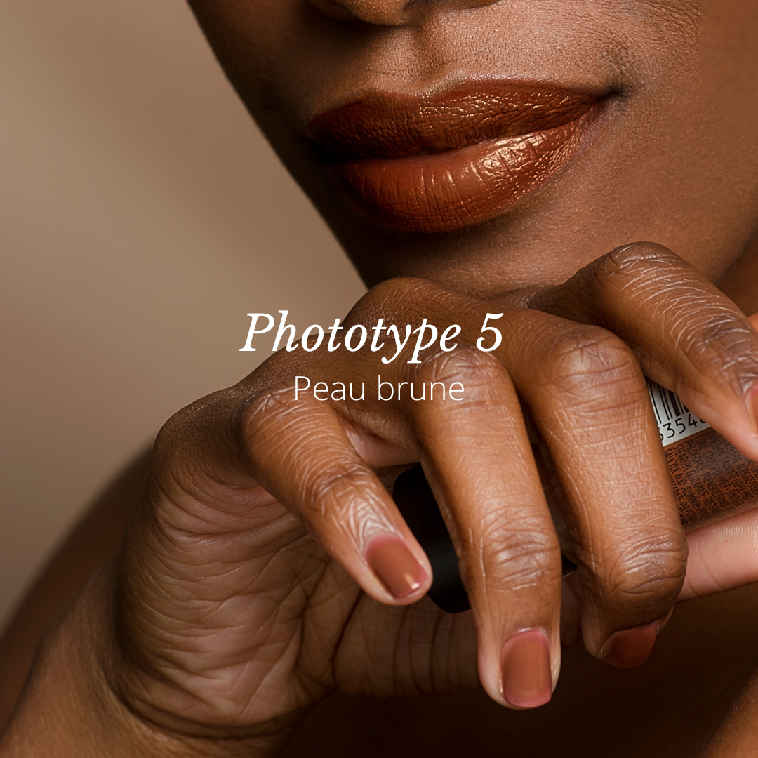 Phototype de peau 5