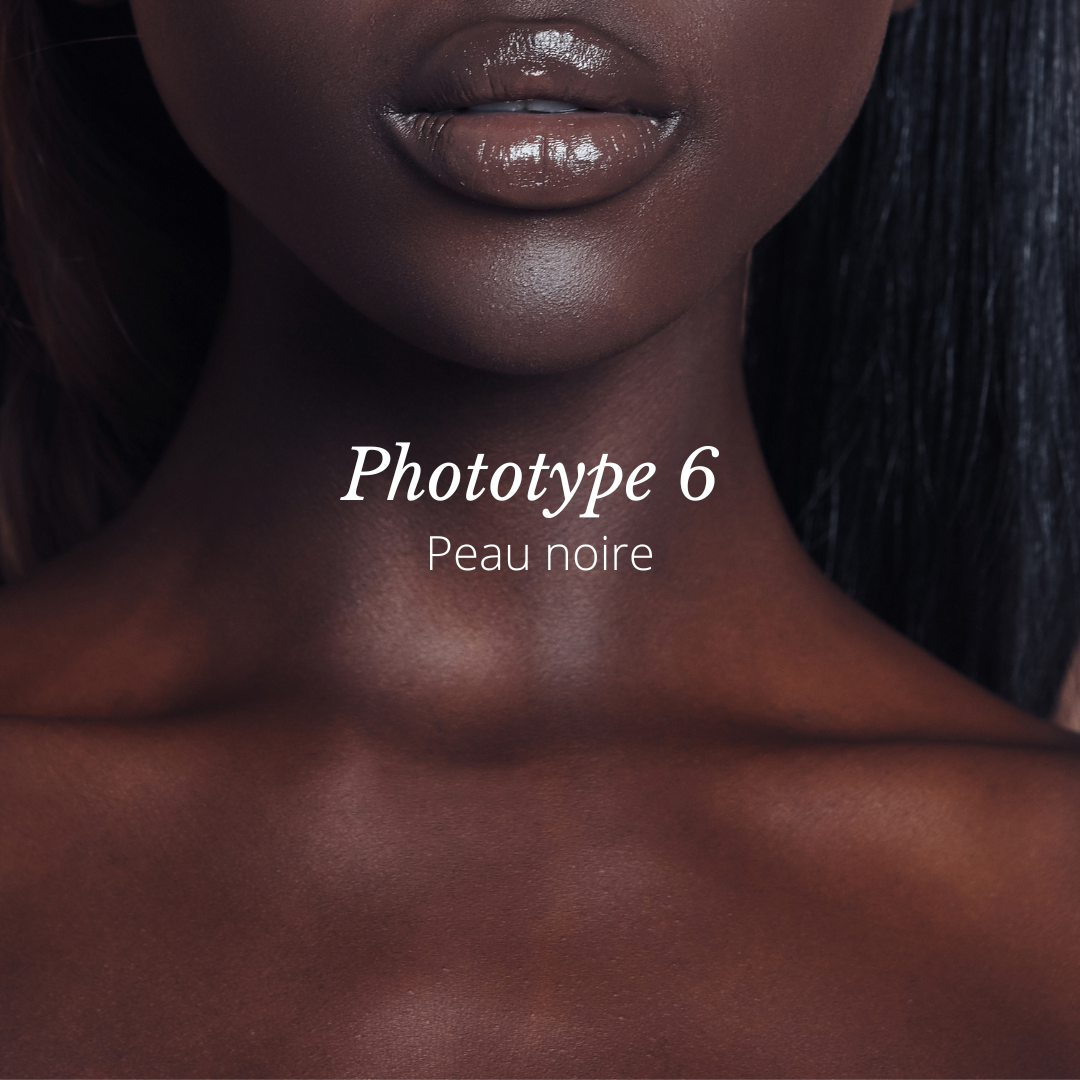 Phototype de peau 6