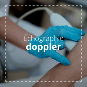 échographie doppler