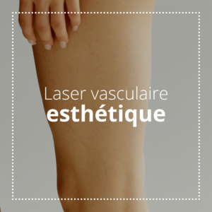 laser vasculaire esthétique