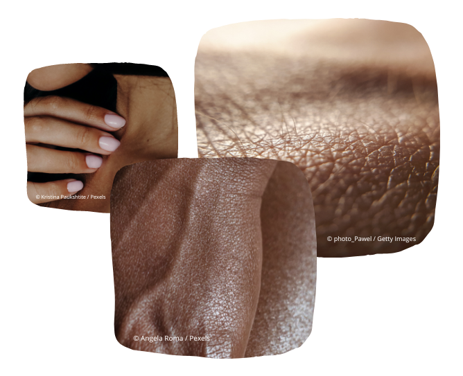 La surface de la peau