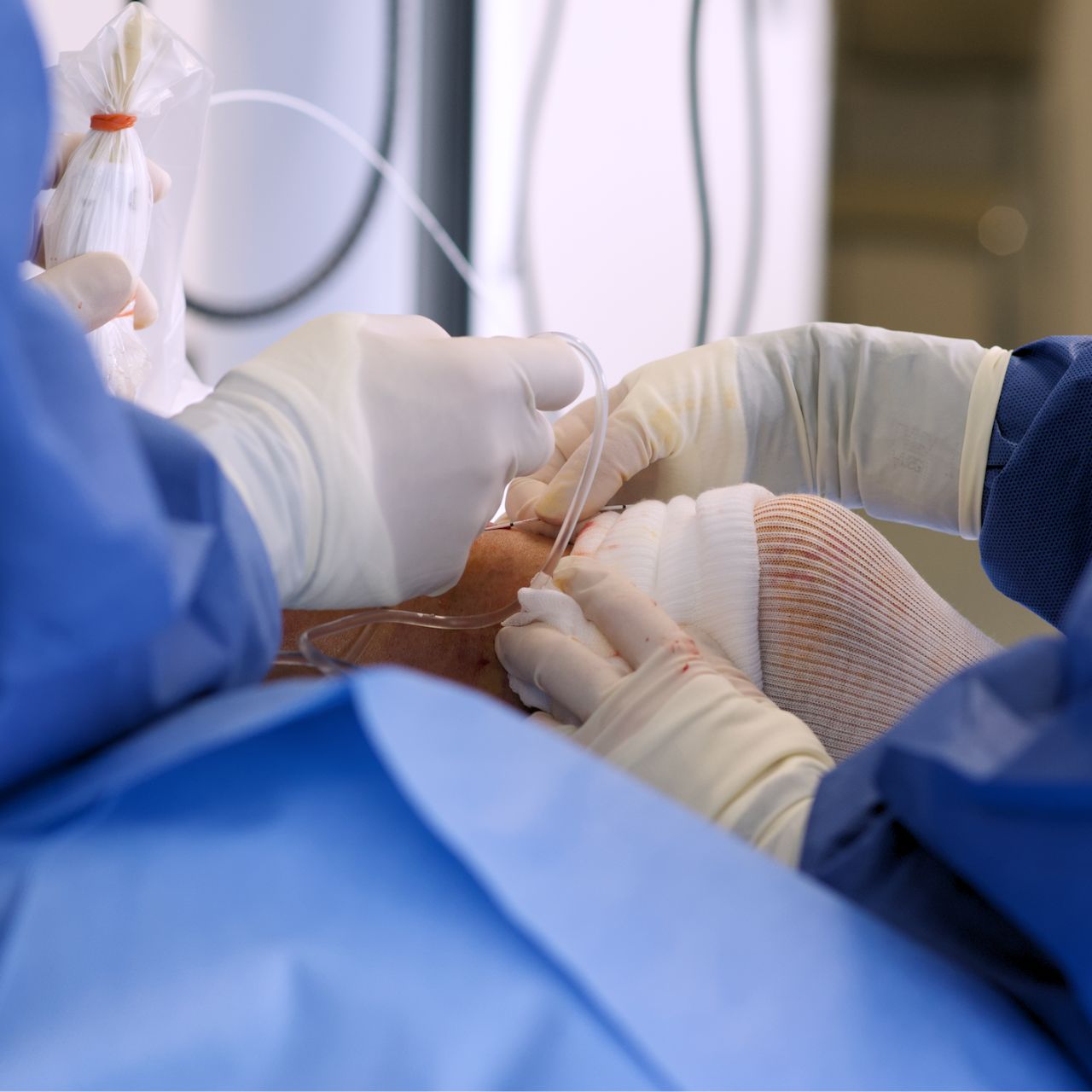 Traitement des varices à Ploemeur